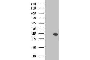 Western Blotting (WB) image for anti-Translocase of Outer Mitochondrial Membrane 34 (TOMM34) antibody (ABIN1501465) (TOMM34 anticorps)