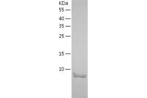 Western Blotting (WB) image for K(lysine) Acetyltransferase 2A (KAT2A) (AA 727-837) protein (His tag) (ABIN7123656)