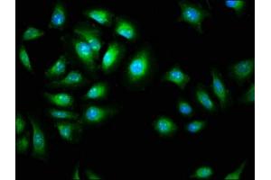 Immunofluorescence staining of A549 cells with ABIN7144036 at 1:266, counter-stained with DAPI. (AMIGO2 anticorps  (AA 420-522))