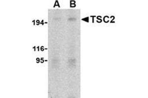 Western blot analysis of TSC2 in L1210 cell lysate with this product at (A) 2 and (B) 4 μg/ml. (Tuberin anticorps  (N-Term))