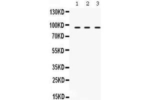 Western Blotting (WB) image for anti-Transporter 1, ATP-Binding Cassette, Sub-Family B (MDR/TAP) (TAP1) (AA 438-471), (Middle Region) antibody (ABIN3043943) (TAP1 anticorps  (Middle Region))