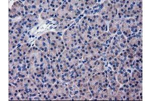 Immunohistochemical staining of paraffin-embedded Human pancreas tissue using anti-KATNAL1 mouse monoclonal antibody. (KATNAL1 anticorps)
