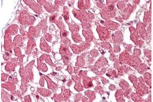 Human Heart (formalin-fixed, paraffin-embedded) stained with CASP12 antibody ABIN462331 followed by biotinylated goat anti-rabbit IgG secondary antibody ABIN481713, alkaline phosphatase-streptavidin and chromogen.