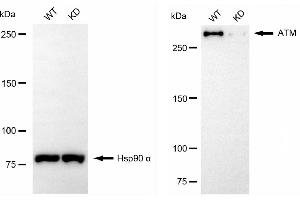 Western blotting analysis using ATM antibody (ABIN7797667).
