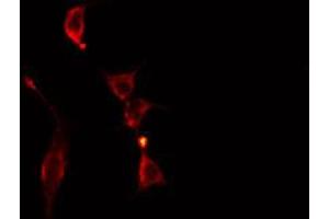 ABIN6273751 staining Hela cells by IF/ICC. (CYP17A1 anticorps  (Internal Region))