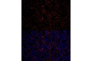 Immunofluorescence analysis of rat kidney cells using  Rabbit pAb (ABIN3016811, ABIN3016812, ABIN3016813, ABIN1678723 and ABIN6219847) at dilution of 1:150 (40x lens).