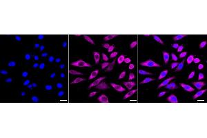 anti-Non-SMC Condensin I Complex, Subunit D2 (NCAPD2) antibody