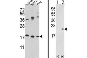 Western Blotting (WB) image for anti-Cofilin 1 (CFL1) antibody (ABIN3001704) (Cofilin anticorps)