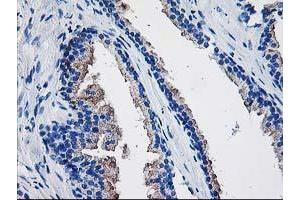 Immunohistochemical staining of paraffin-embedded Human prostate tissue using anti-TBC1D21 mouse monoclonal antibody. (TBC1D21 anticorps)