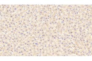 Detection of ITIH4 in Rat Liver Tissue using Polyclonal Antibody to Inter Alpha-Globulin Inhibitor H4 (ITIH4)