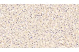 Detection of ITIH4 in Rat Liver Tissue using Polyclonal Antibody to Inter Alpha-Globulin Inhibitor H4 (ITIH4) (ITIH4 anticorps  (AA 478-722))