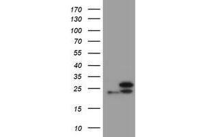 Image no. 1 for anti-Ubiquitin-Conjugating Enzyme E2E 3 (UBE2E3) antibody (ABIN1501626) (UBE2E3 anticorps)