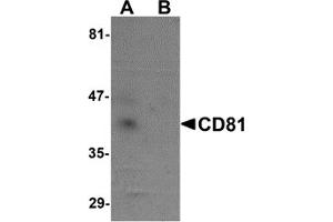 Western Blotting (WB) image for anti-CD81 (CD81) (N-Term) antibody (ABIN1031309) (CD81 anticorps  (N-Term))