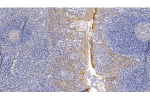 Detection of CK17 in Human Tonsil Tissue using Monoclonal Antibody to Cytokeratin 17 (CK17) (KRT17 anticorps  (AA 252-393))