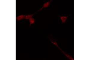 ABIN6274368 staining HeLa cells by IF/ICC. (TAF1A anticorps  (Internal Region))