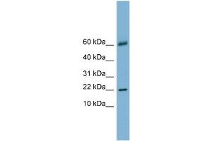 WB Suggested Anti-LGALS14 Antibody Titration:  0.