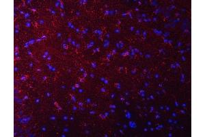 IF analysis of Septin 2/SEPTIN2 using anti-Septin 2/SEPTIN2 antibody (ABIN7599275). (Septin 2 anticorps  (AA 1-326))