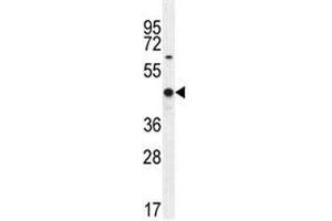 WT1 antibody western blot analysis in MCF-7 lysate.