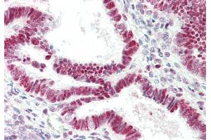 Rabbit Anti-RNASEH1 antibody  Formalin Fixed Paraffin Embedded Tissue: Human Uterus Primary antibody Concentration: 1:100 Secondary Antibody: Donkey anti-Rabbit-Cy3 Secondary Antibody Concentration: 1:200 Magnification: 20x Exposure Time: 0.