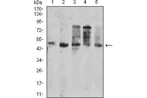 Western blot analysis using CD177 mouse mAb against SPC-A-1 (1), SK-MES-1 (2), HepG2 (3), HL-60 (4), and PC-3 (5) cell lysate.