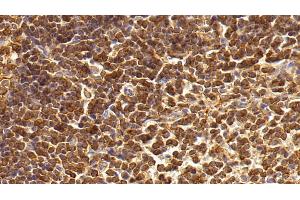 Detection of IL17 in Rabbit Spleen Tissue using Monoclonal Antibody to Interleukin 17 (IL17)