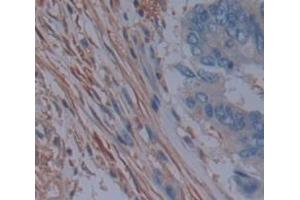 IHC-P analysis of Human Tissue, with DAB staining. (MAP2K7 anticorps  (AA 113-388))