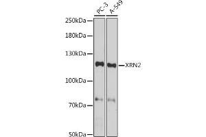 Western blot analysis of extracts of various cell lines, using XRN2 antibody (ABIN7265345) at 1:1000 dilution. (XRN2 anticorps)