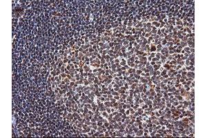 Image no. 9 for anti-Tripartite Motif Containing 38 (TRIM38) (AA 1-265) antibody (ABIN1490681) (TRIM38 anticorps  (AA 1-265))