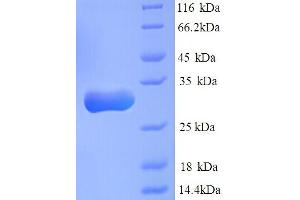 SDS-PAGE (SDS) image for Carbonyl Reductase 1 (CBR1) (AA 45-320), (partial) protein (His tag) (ABIN5713318)