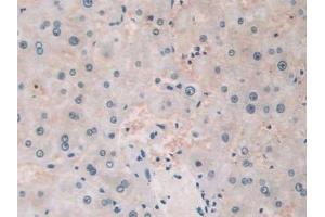 Detection of TLR3 in Human Liver Tissue using Polyclonal Antibody to Toll Like Receptor 3 (TLR3)