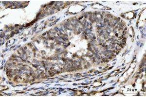 IHC analysis of HES5 using anti-HES5 antibody (ABIN7598966).
