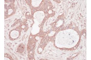 Immunohistochemistry (IHC) image for anti-Sequestosome 1 (SQSTM1) (AA 325-375) antibody (ABIN7454876) (SQSTM1 anticorps  (AA 325-375))