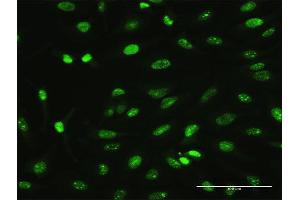 Immunofluorescence of monoclonal antibody to MAGEA2 on HeLa cell.