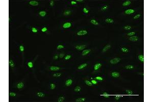 Immunofluorescence of monoclonal antibody to MAGEA2 on HeLa cell. (MAGEA2 anticorps  (AA 1-314))
