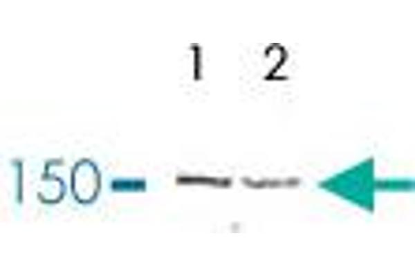 TTC37 anticorps