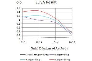 Black line: Control Antigen (100 ng),Purple line: Antigen (10 ng), Blue line: Antigen (50 ng), Red line:Antigen (100 ng)