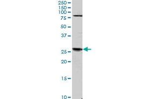 TGIF2 monoclonal antibody (M01), clone 4C10.