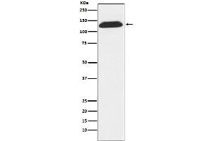 Western blot analysis of DNA Ligase I expression in Molt4 cell lysate.