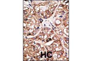 Image no. 1 for anti-Neuronal Differentiation 1 (NEUROD1) (AA 15-45) antibody (ABIN2451575)