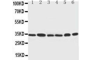 Anti-Cdk4 antibody,  Western blotting Lane 1: Rat Thymus Tissue Lysate Lane 2: HELA Cell Lysate Lane 3: MCF-7 Cell Lysate Lane 4: A549 Cell Lysate Lane 5: COLO320 Cell Lysate Lane 6: JURKAT Cell Lysate
