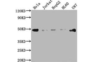 Western Blot Positive WB detected in: Hela whole cell lysate, Jurkat whole cell lysate, HepG2 whole cell lysate, HL60 whole cell lysate, U87 whole cell lysate All lanes: FAS antibody at 1:2000 Secondary Goat polyclonal to rabbit IgG at 1/50000 dilution Predicted band size: 38, 12, 10, 17, 15, 36, 25 kDa Observed band size: 45 kDa (Recombinant FAS anticorps)