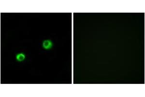 Immunofluorescence analysis of MCF7 cells, using ARSI Antibody. (Arylsulfatase I anticorps  (AA 311-360))
