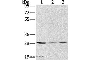 Western blot analysis of A375, hela and A172 cell, using HSD17B12 Polyclonal Antibody at dilution of 1:570 (HSD17B12 anticorps)