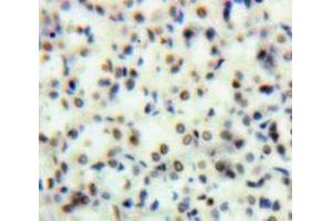 Used in DAB staining on fromalin fixed paraffin-embedded Kidney tissue