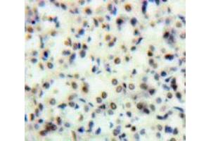 Used in DAB staining on fromalin fixed paraffin-embedded Kidney tissue (TOP2 anticorps  (AA 749-987))