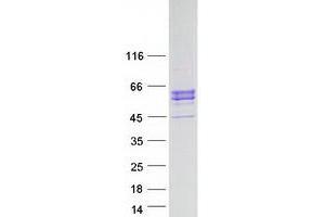 Validation with Western Blot