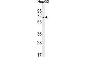 ZNF860 Antibody (C-term) western blot analysis in HepG2 cell line lysates (35 µg/lane).