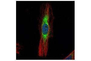 ICC/IF Image Confocal immunofluorescence analysis (Olympus FV10i) of methanol-fixed HeLa, using SCIN, antibody (Green) at 1:500 dilution.