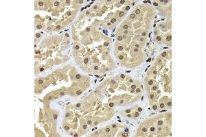 Immunohistochemistry of paraffin-embedded human kidney using ACTL6B antibody.