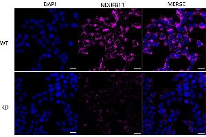 Immunocytochemical staining of HeLa cells using NDUFB11 antibody (ABIN7799549), 1:1,000), Top panel: wild-type (WT), Bottom panal: NDUFB11 shRNA knockdown (KD). (NDUFB11 anticorps)